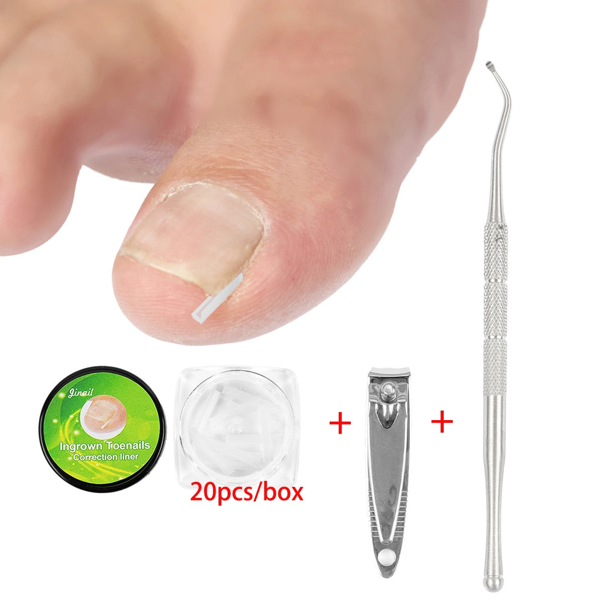 Ingrown Nail Pad Set Filling Groove Pad Toenail Corrector