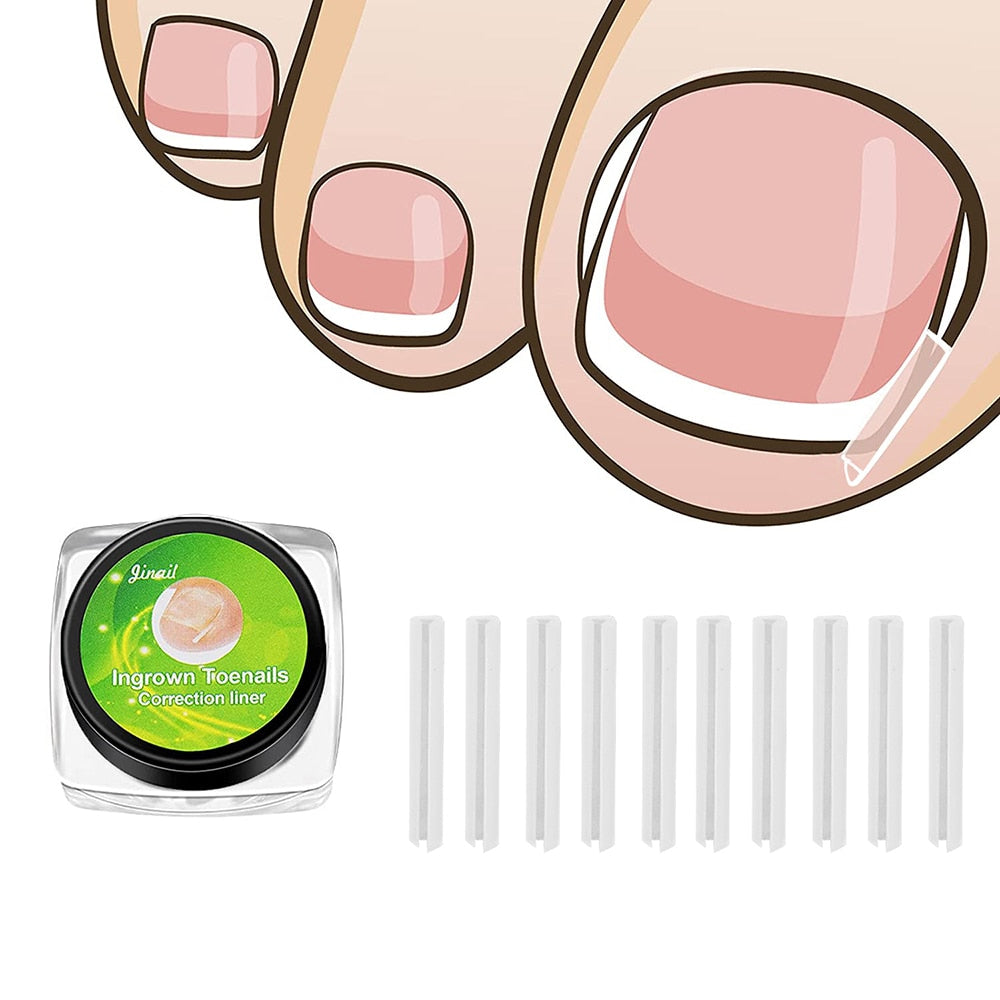 Ingrown Nail Pad Set Filling Groove Pad Toenail Corrector